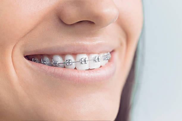 Why Choose Us for Your Dental Needs in Fontana, CA